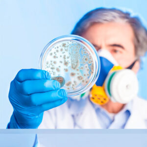 CONTROL DE CONTAMINACIÓN MICROBIOLÓGICA EN PRODUCTOS PARA DIAGNÓSTICO CLÍNICO - INTERMEDIO